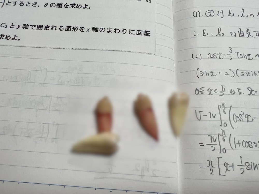抜歯した歯3本と数学のノート